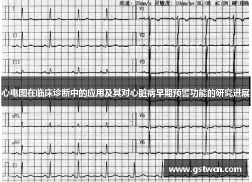 心电图在临床诊断中的应用及其对心脏病早期预警功能的研究进展